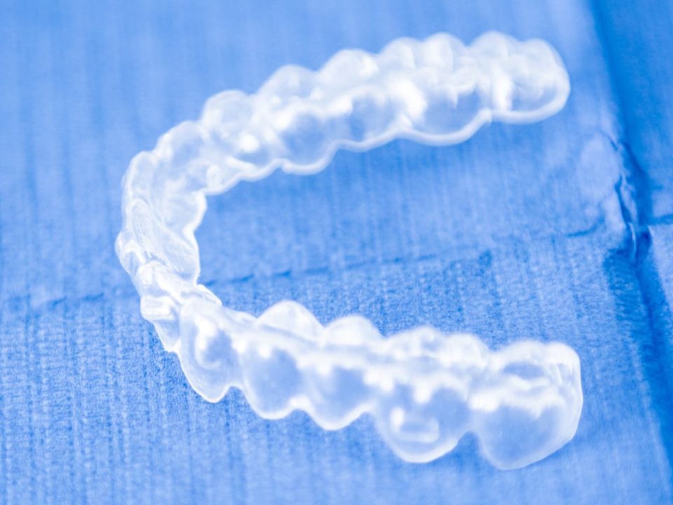 invisalign denti